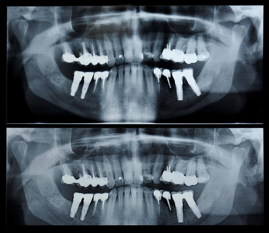 Oral diagnoz RVG