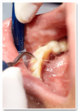 Periodontoloji